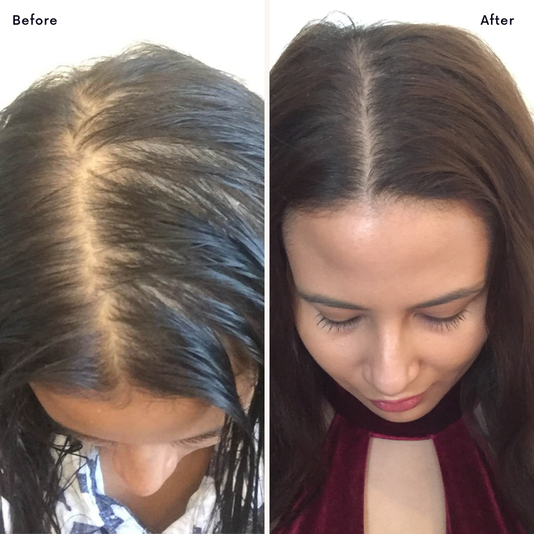 Miracle Hair Oil